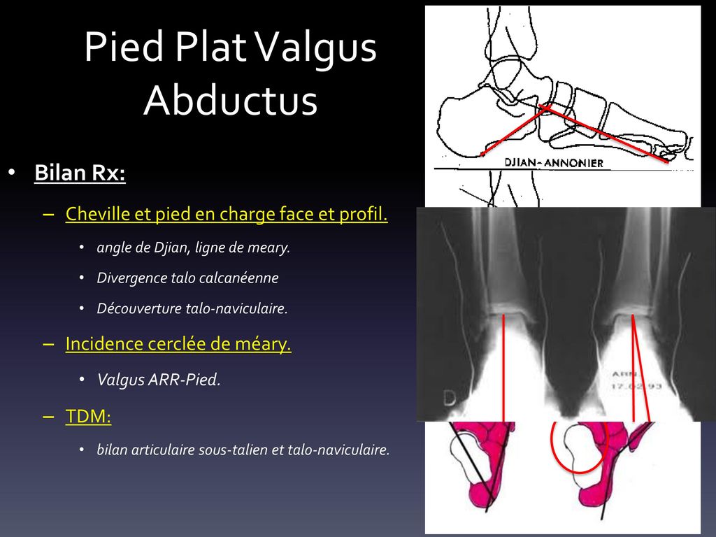 Cabinet de chirurgie orthop dique le Liner Al s. ppt video